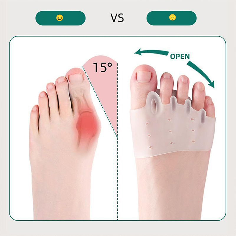 Forefoot Pads Shoe Pad Silicon - Toe Separator Silicon recensie en prijs
