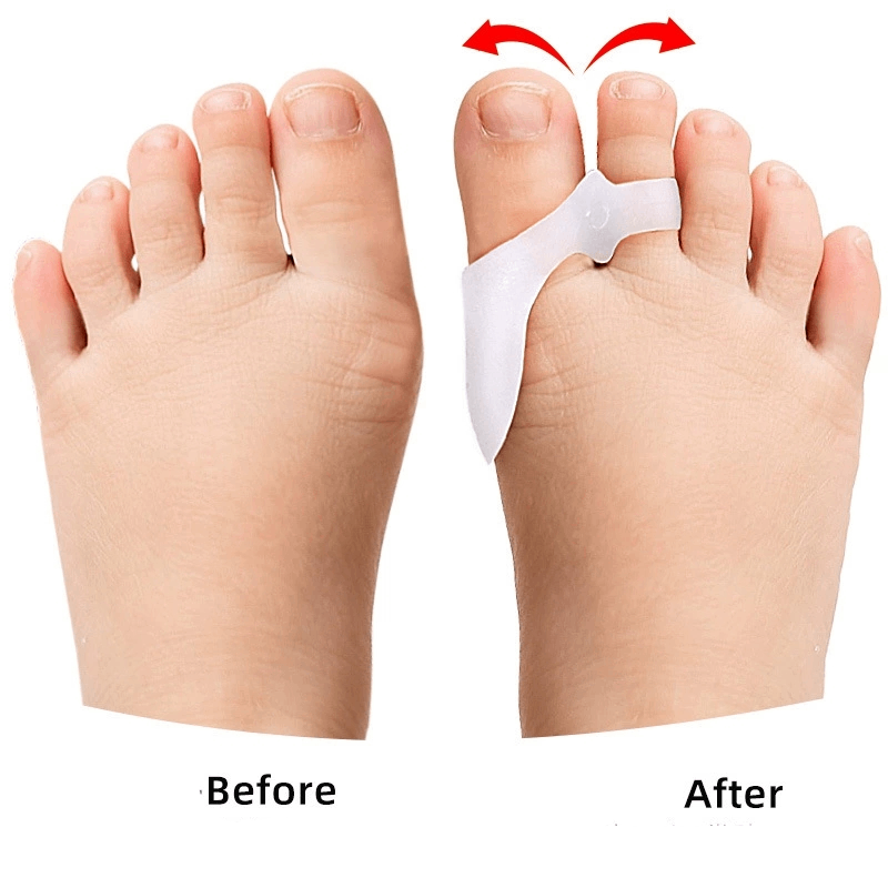 1/2/3Pairs Children's Gel Toe  - Toe Separator Silicon recensie en prijs