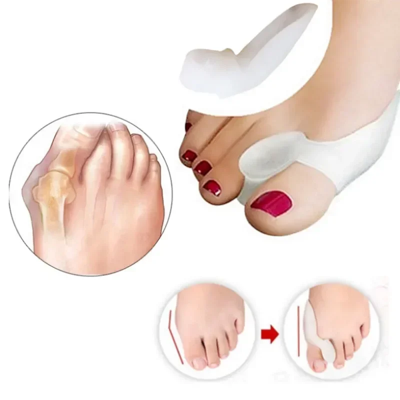 2PCS Silicone Gel Thumb Correc - Toe Separator Silicon recensie en prijs