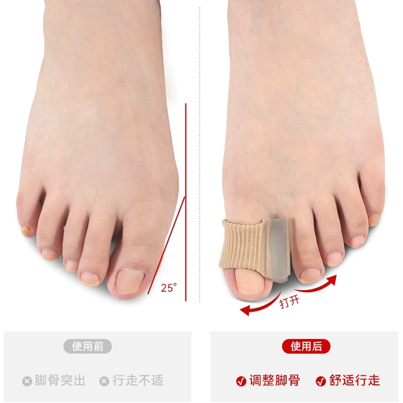 1/10Pcs Gel Toe Separators  Co - Toe Separator Silicon recensie en prijs